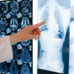 Techniques to Keep Your Lungs Young and Strong